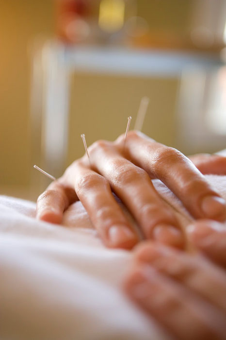 woman with facial accupuncture